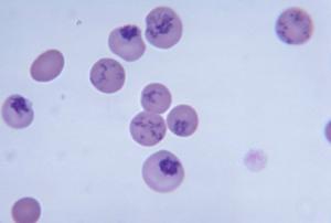 Mammal blood reticulocytes. LM